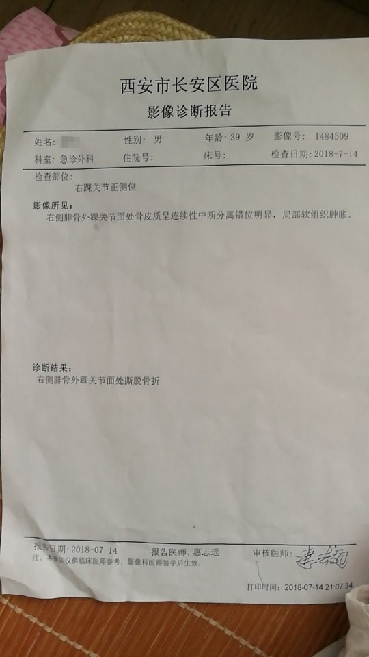 2018年7月14日,右脚外踝撕脱性骨折