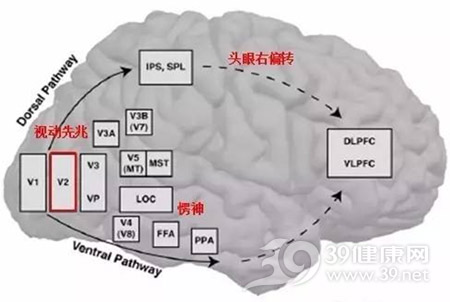 胚胎发育不良性神经上皮肿瘤