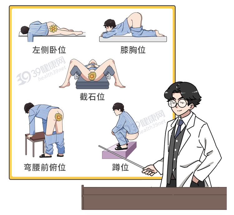 健康肛门 正常图片