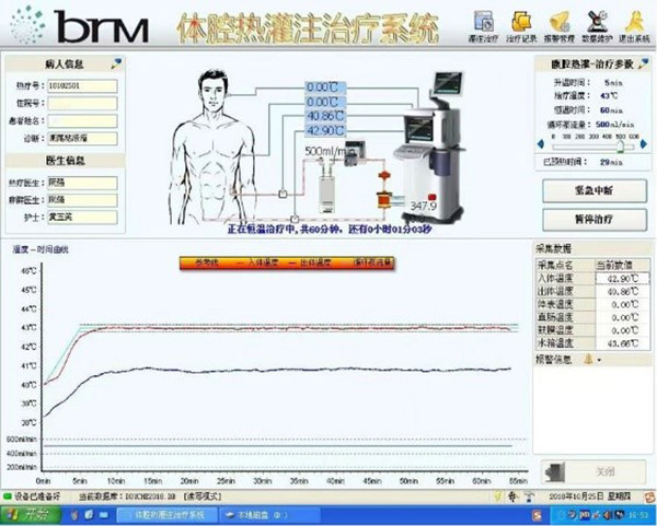国内首部！广东专家牵头完成妇科肿瘤腹腔热灌注化疗指南